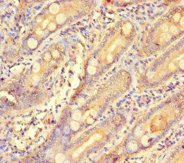 GCHFR Antibody