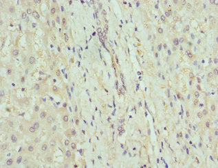 GDA Antibody