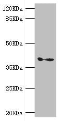 GDAP1 Antibody