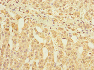 GLP2R Antibody