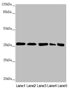 GNB2 Antibody