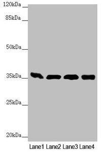 GNB2 Antibody