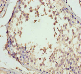 GNS Antibody
