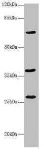 GNS Antibody