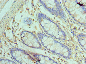 GOLM1 Antibody