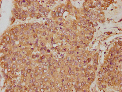 GOT1 Antibody