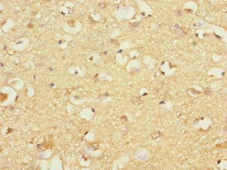 GP1BB Antibody