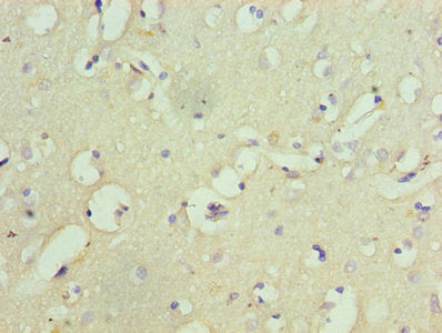 GRIA1 Antibody