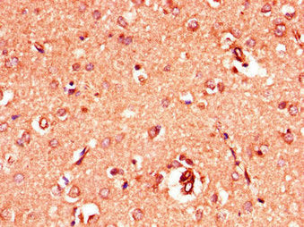 GRIA4 Antibody