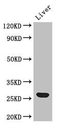 GSTA1 Antibody