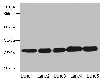 GSTK1 Antibody