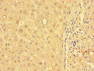 GSTM1 Antibody