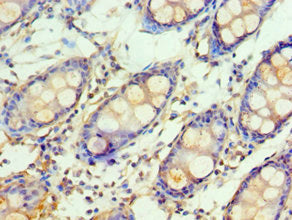 GSTM4 Antibody