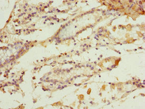 GSTZ1 Antibody