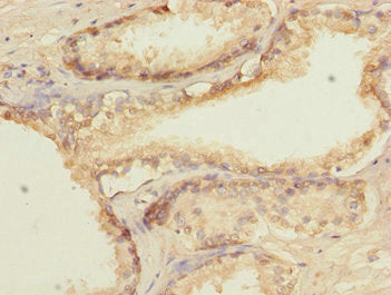 GTF2A2 Antibody