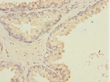 GTF2A2 Antibody