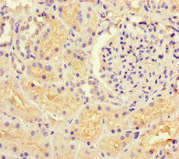 GUCY1A1 Antibody