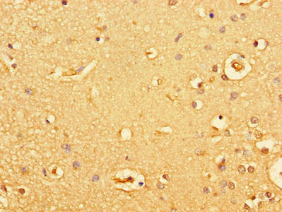 GUCY2C Antibody