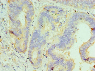 GUSB Antibody