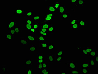 Mono-methyl-H2AFZ (K4) Antibody