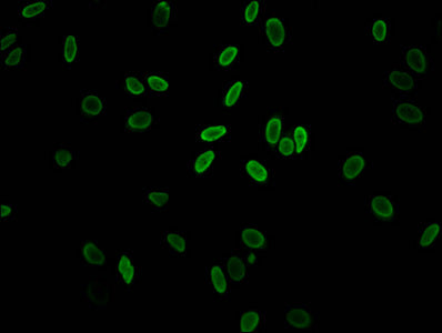 Acetyl-H2AFZ (K11) Antibody