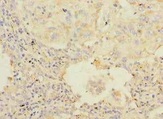 HAND1 Antibody