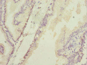HAND2 Antibody