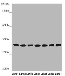 HCCS Antibody