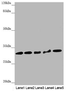 HCCS Antibody