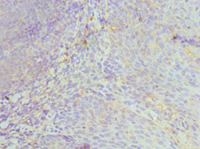 HCK Antibody