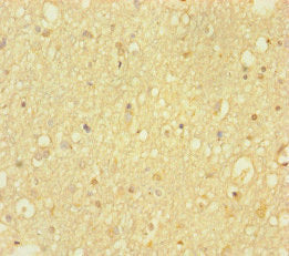 HDAC5 Antibody