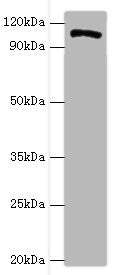 HIP1 Antibody