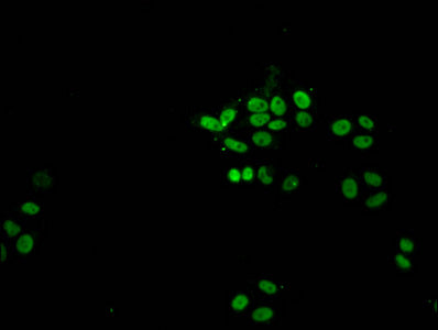Acetyl-HIST1H1A (K21) Antibody