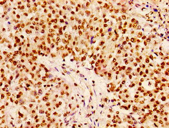HIST1H1B (Ab-10) Antibody