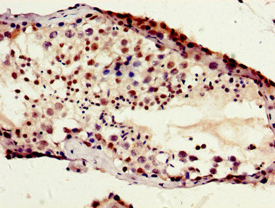 HIST1H1B (Ab-154) Antibody