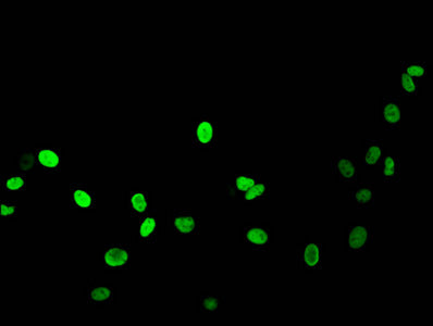 Acetyl-HIST1H1B (K16) Antibody