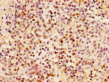 HIST1H1B (Ab-17) Antibody