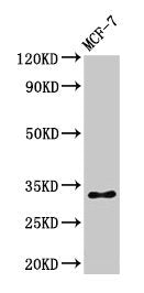 Phospho-HIST1H1B (S17) Antibody