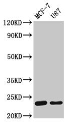 HIST1H1B (Ab-188) Antibody