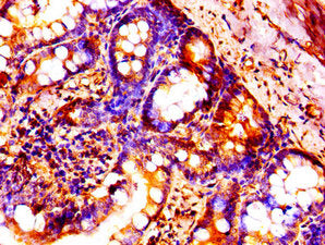 HIST1H1B (Ab-66) Antibody