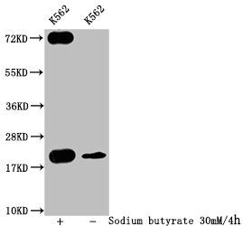 Formyl-HIST1H1C (K109) Antibody