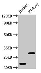 HIST1H1C (Ab-16) Antibody