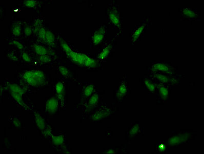 HIST1H1C (Ab-62) Antibody