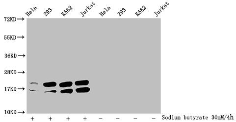 Acetyl-HIST1H1C (K96) Antibody