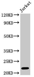 HIST1H1C (Ab-96) Antibody