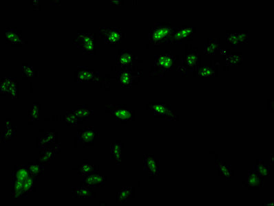HIST1H1D (Ab-16) Antibody
