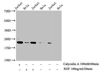 Phospho-HIST1H1E (T17) Antibody