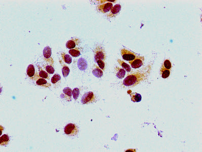 Acetyl-HIST1H1E (K16) Antibody