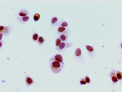 Di-methyl-HIST1H1E (K16) Antibody