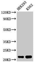 HIST1H1E (Ab-16) Antibody